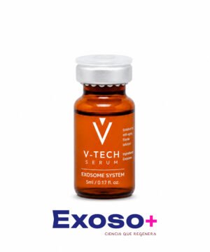 V-Tech System